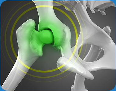 An illustration of a healthy dog's joint
